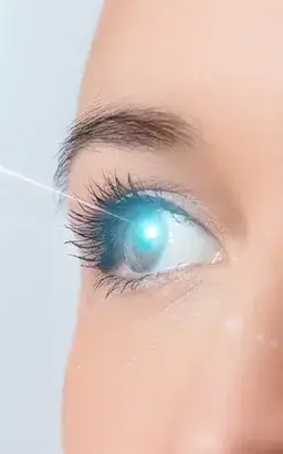 Lasik