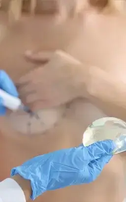 BREAST AUGMENTATION